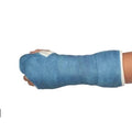 Plus Fiberglass Cast Tape – 2in x 4yd, Light Blue – Strong & Lightweight – Part by Unknown