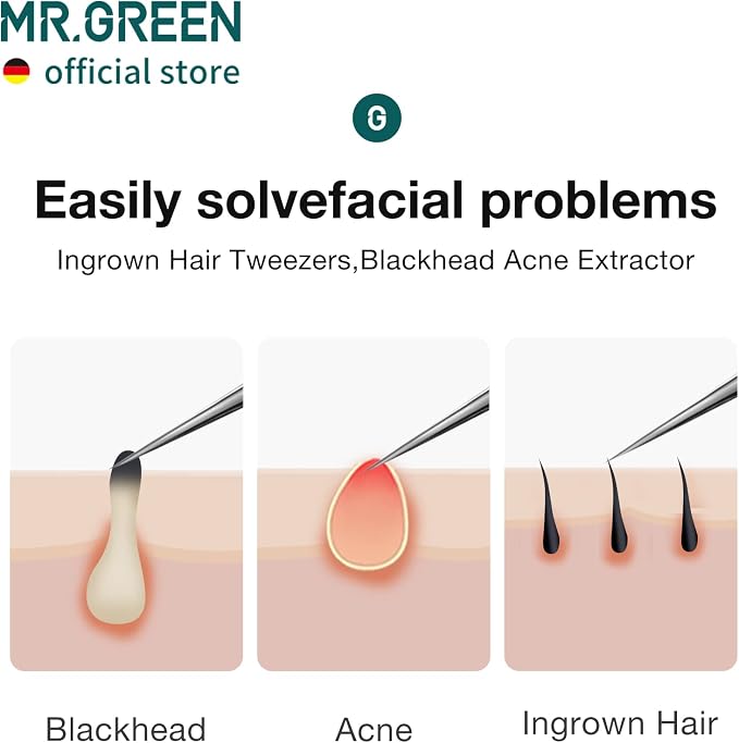 MR.GREEN Ingrown Hair Tweezers Needle Nose Pointed Tips Tweezers - Image 3