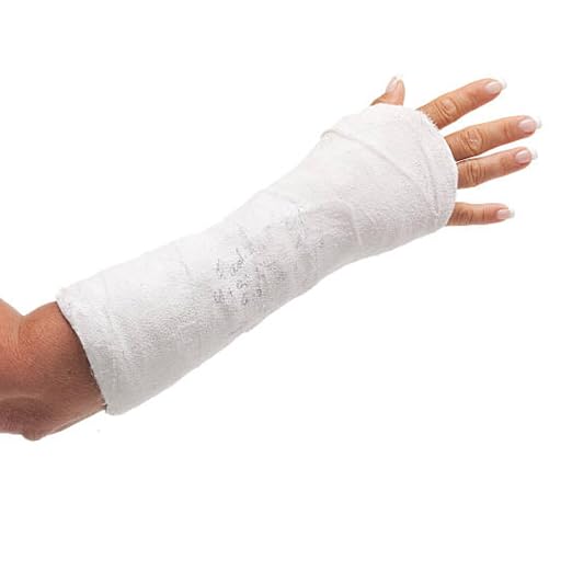 Conformable Polyester Casting Tape, Lightweight & Water-Resistant by Unknown