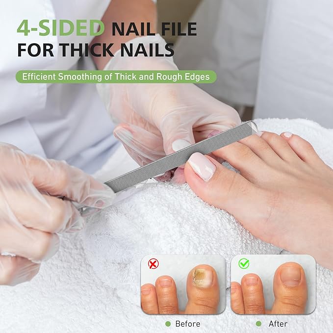 BALUCA Toenail File for Thick Nails & Ingrown Relief | Heavy Duty Metal Emery Board with Toenail Lifter for Seniors, Coarse Grit & Durable Stainless Steel Design (Silver, 1.0, Count, 180/240 Grit)