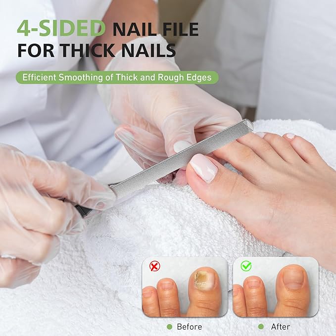 BALUCA Toenail File for Thick Nails & Ingrown Relief | Heavy Duty Metal Emery Board with Toenail Lifter for Seniors, Coarse Grit & Durable Stainless Steel Design (Black, 1.0, Count, 180/240 Grit)